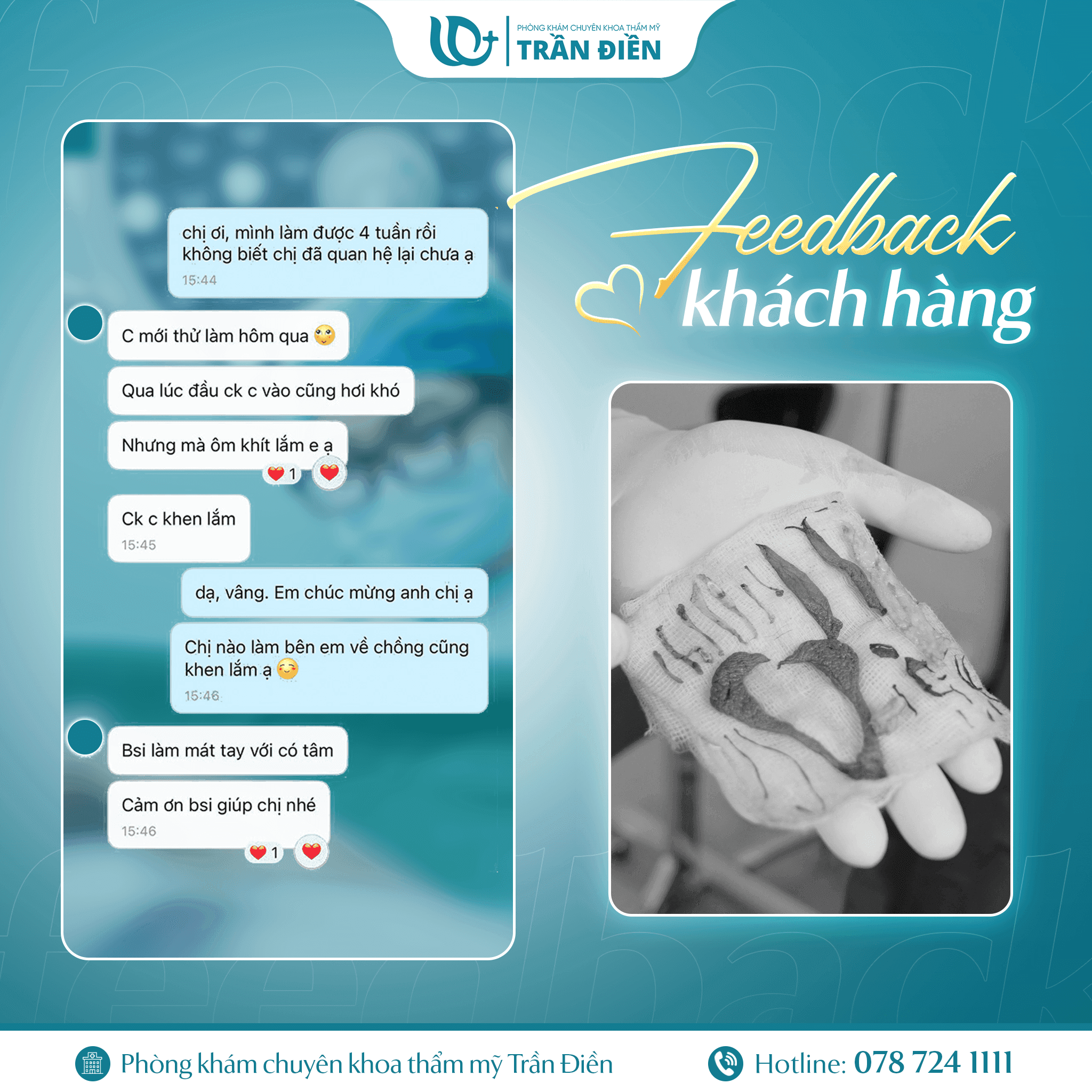 Feedback Khách Hàng