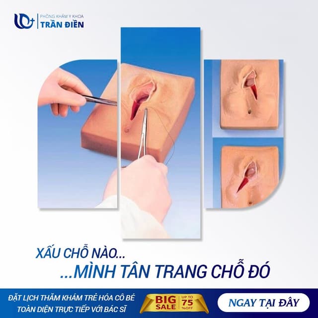 Xấu Ở Đâu – Tân Trang Ở Đó 