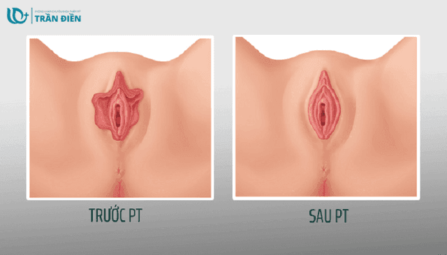    Thế Nào Là Một ‘‘CÔ BÉ’’ Đạt Chuẩn