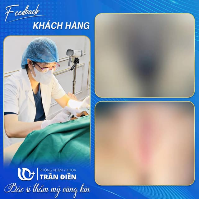 Chị N.Hiền - 47 tuổi